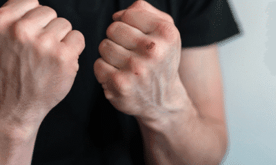 Патрулка пред жилищен блок в Русе